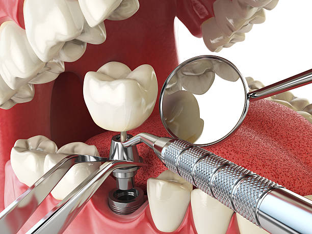 Fast & Reliable Emergency Dental Services in SD